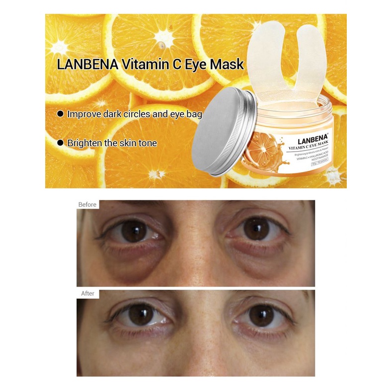 LANBENA Mặt Nạ Mắt Vitamin C Dưỡng Ẩm Chống Bọng Mắt Và Quầng Thâm Làm Săn Chắc Da 50pcs | BigBuy360 - bigbuy360.vn