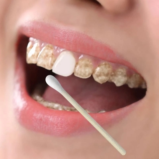 Bột Làm Trắng Răng Chất Lượng Cao