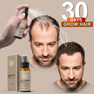 Chai Xịt Kích Thích Mọc Tóc Ngăn Ngừa Rụng Tóc 30ml