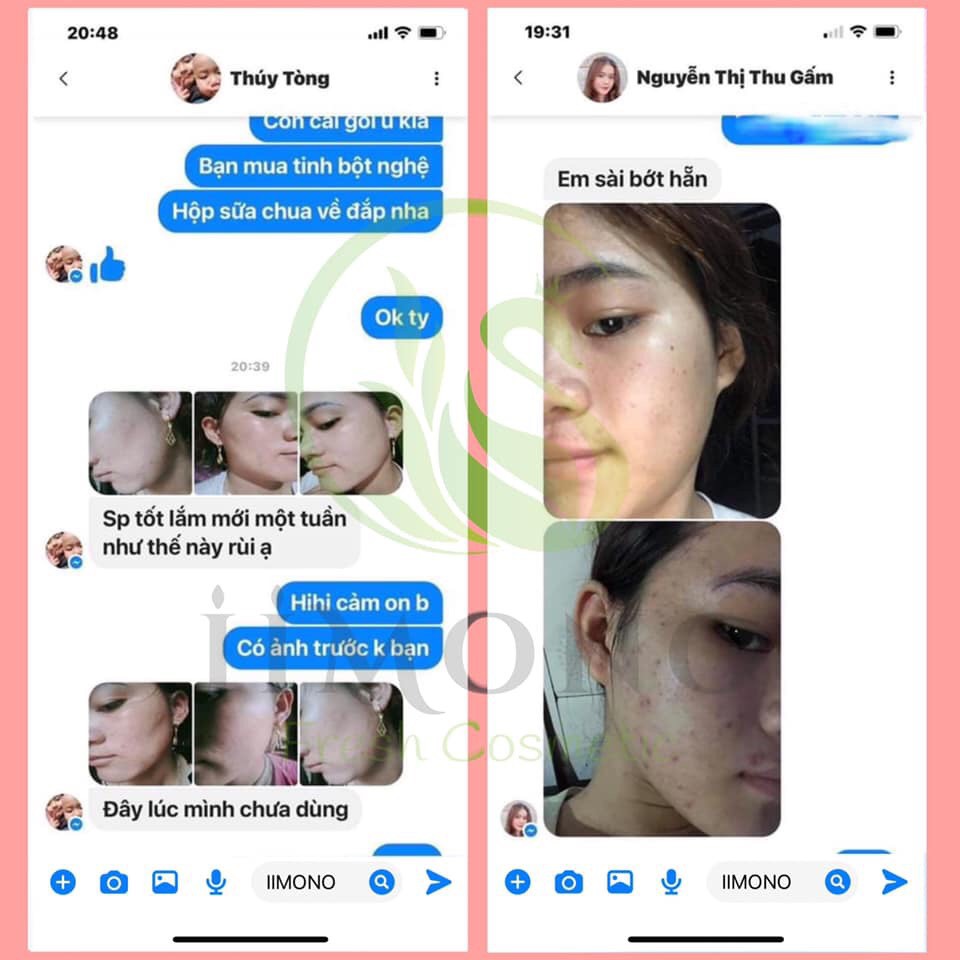 Ngừa mụn đầu đen IIMONO | BigBuy360 - bigbuy360.vn