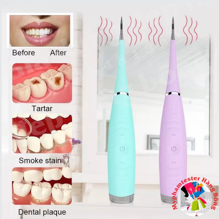 (SIÊU HOT) Máy lấy cao răng mini 3 chế độ rung, sạc điện tiện dụng