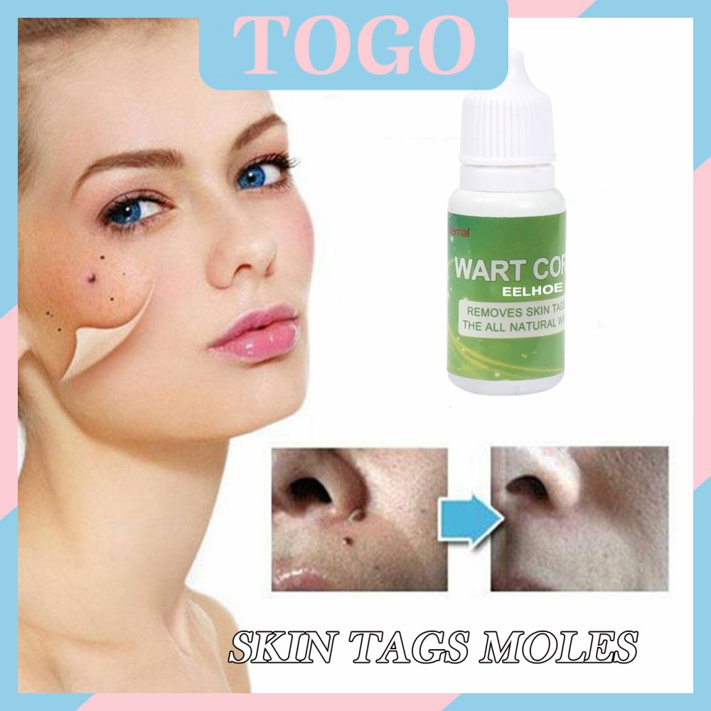 ☀☀☀ Skin Tag Cure Removal Body Mole Wart Remover Spot Marks Wart Remover ☝☝☝