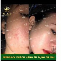 (TẶNG MIẾNG DÁN LỘT MỤN ĐẦU ĐEN) serum Tri mun thảo mộc Mai dùng cho mọi lứa tuổi an toàn cho cả mẹ bầu | BigBuy360 - bigbuy360.vn