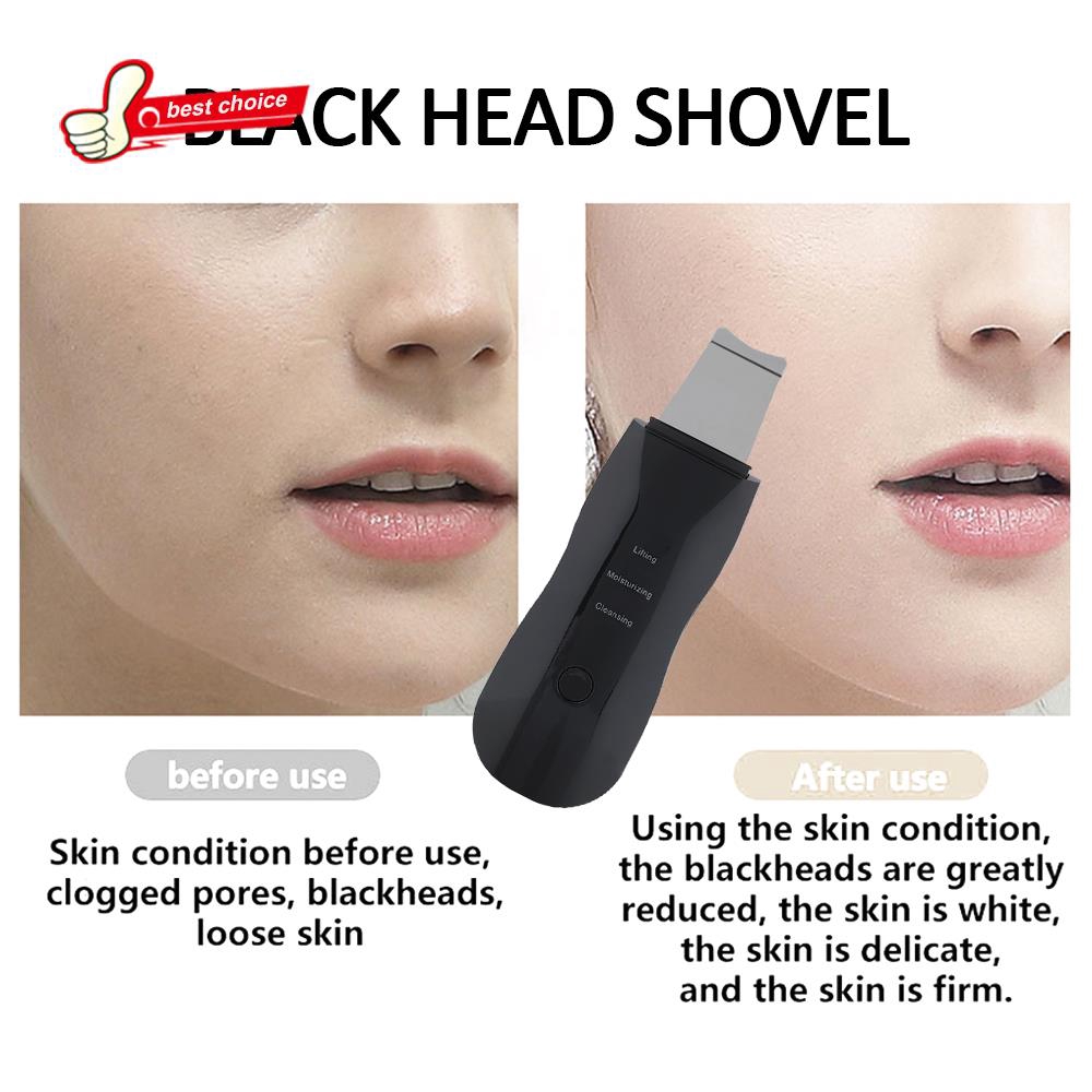 Máy cà da hút mụn làm đẹp hiệu quả màu đen | BigBuy360 - bigbuy360.vn