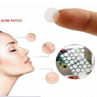 Bộ 24 Miếng Dán Mụn Hydrocolloid Chăm Sóc Da