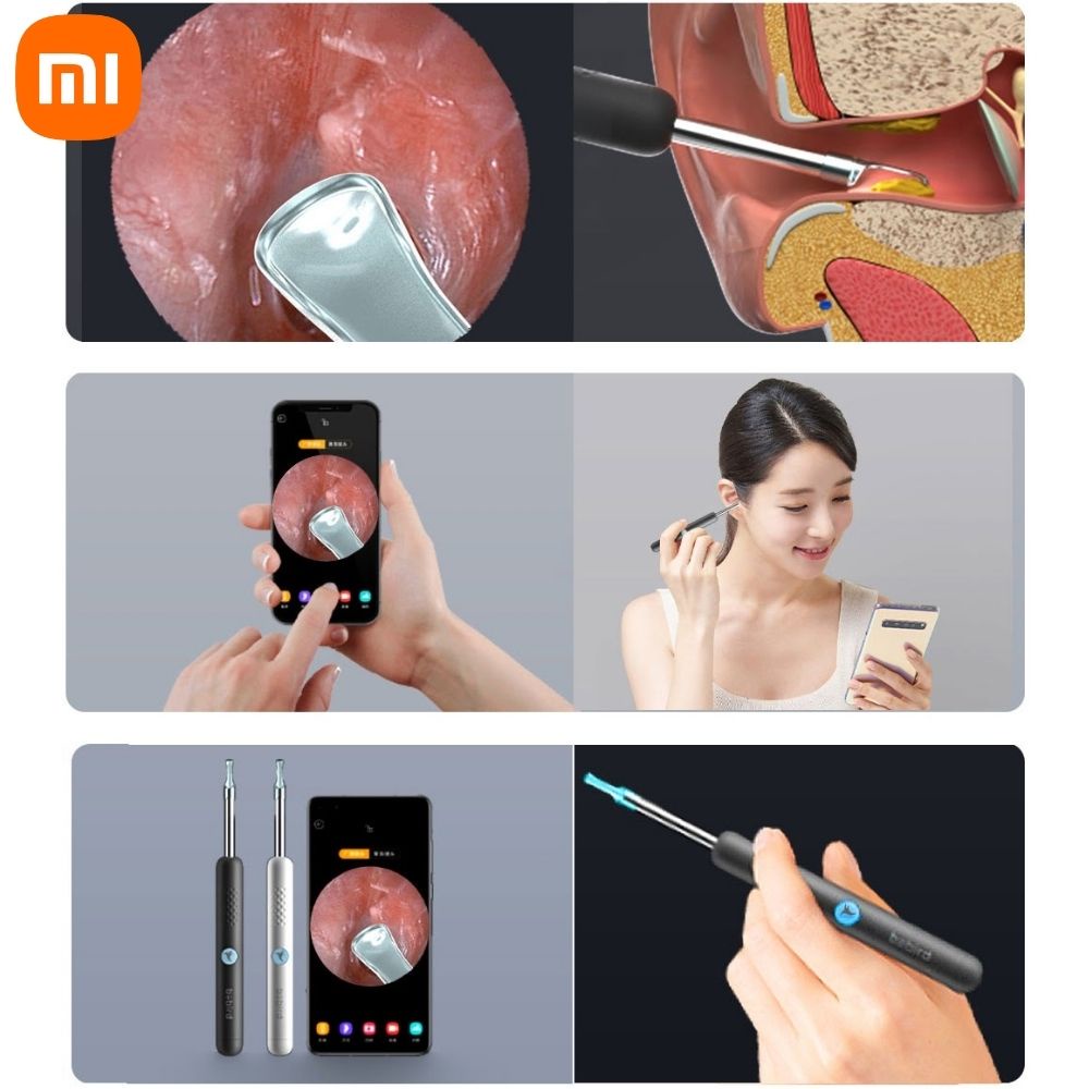 Dụng cụ lấy ráy tai Xiaomi Bebird R1, nội soi bằng camera siêu nét kết nối điện thoại