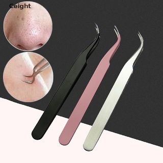 Nhíp lấy mụn đầu đen bằng thép không gỉ tiện dụng
