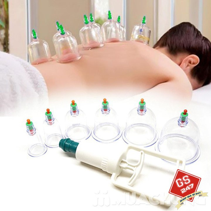 [FREESHIP] Bộ Giác Hơi Không Cần Lửa 12 Ly Kèm 1 Ống Bơm Chuyên Dụng