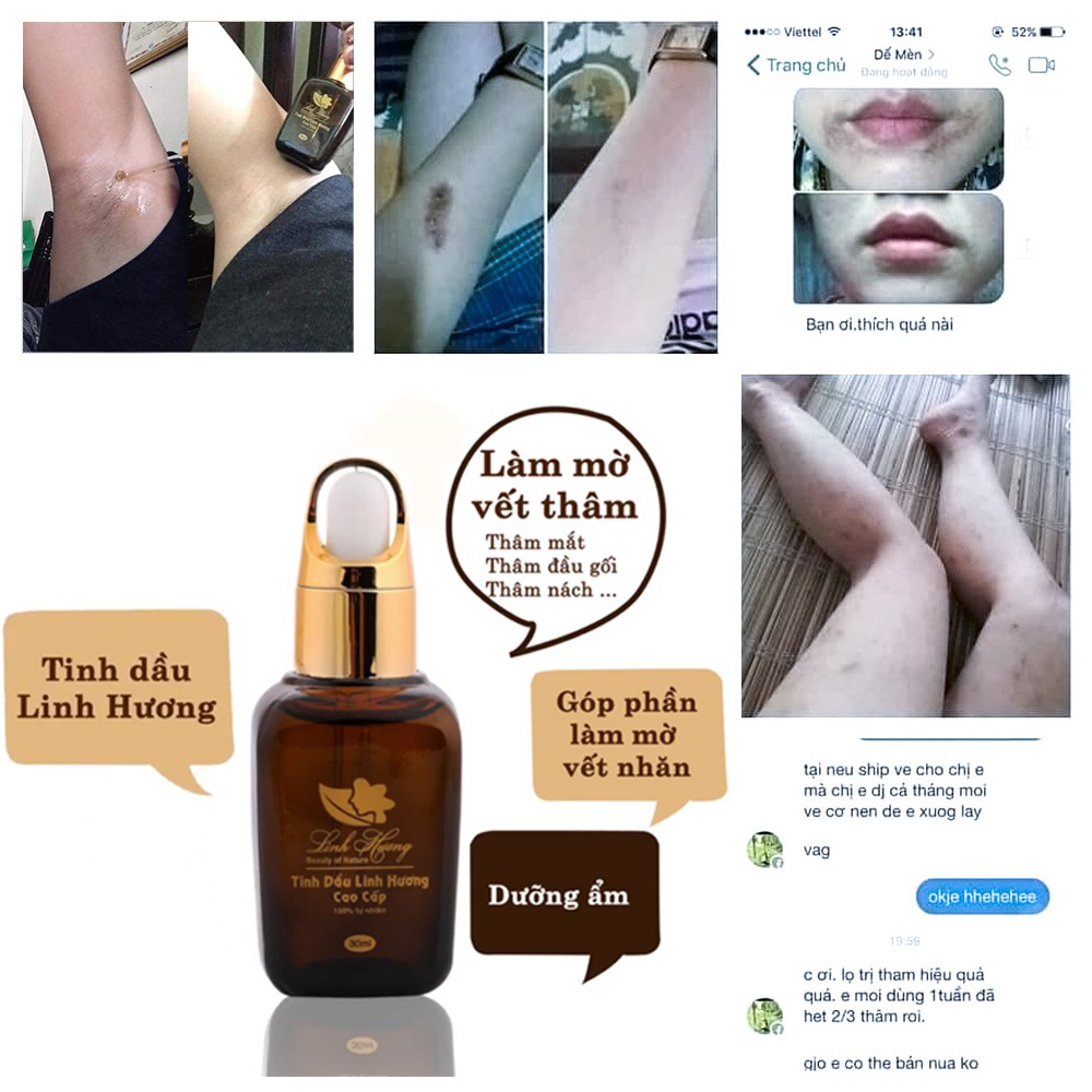 Tinh dầu Linh Hương làm mờ vết thâm da do sẹo, mụn ở mặt đầu gối, nách, nhũ hoa, côn trùng cắn 30ml | BigBuy360 - bigbuy360.vn