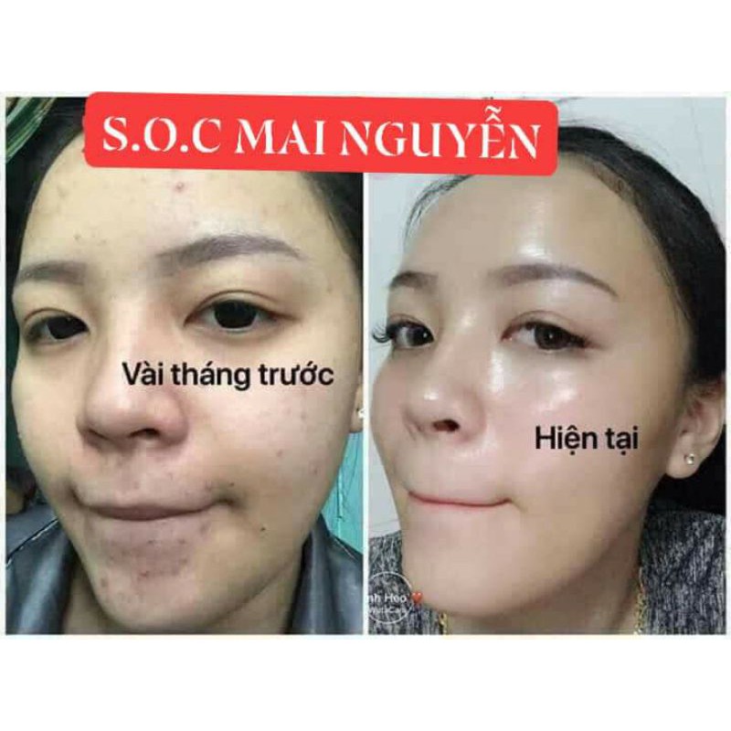 sữa ong chúa tươi  nguyên chất 100%( tặng cọ quét)+ FRRESHIP