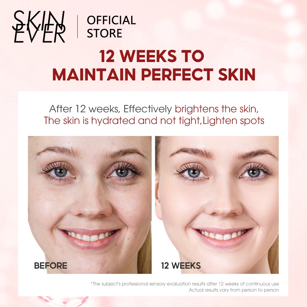 Mặt nạ SKIN EVER chiết xuất sơ ri dưỡng ẩm làm trắng da 25ml
