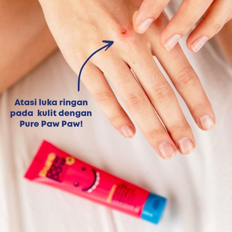 (Hàng Mới Về) Thuốc Mỡ 25g Chiết Xuất Từ Trái Cây / Dâu / Dưa Hấu / Nho / Nho Độc Đáo | BigBuy360 - bigbuy360.vn