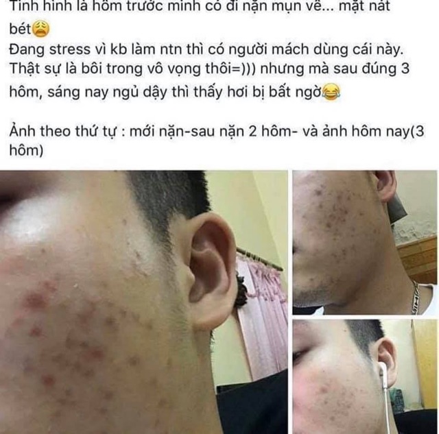 GEL PG COLLAGEN TÁI TẠO DA (MẪU MỚI 80G) | BigBuy360 - bigbuy360.vn