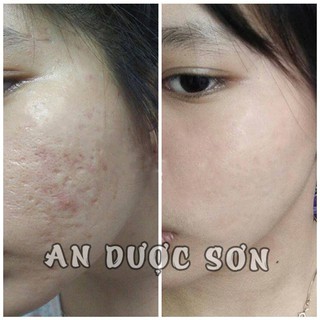 Combo An Dược Sơn Serum Và Bột Thảo Dược 30ml