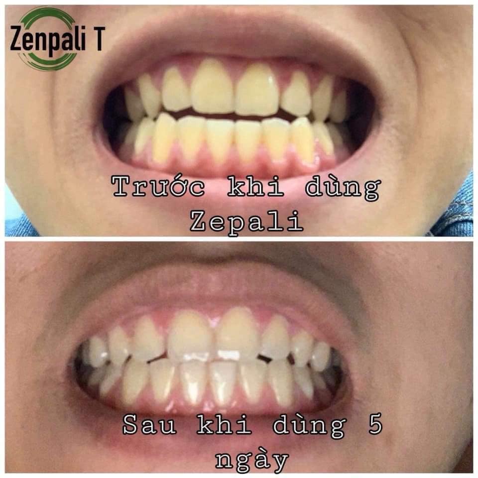 Zenpali Bột than tre hoạt tính trắng răng - Hàng Chuẩn Công ty