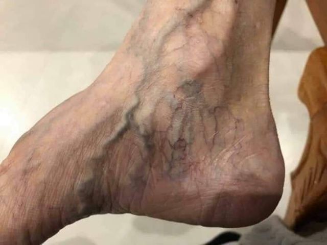 Dầu xoa bóp thảo mộc dân tộc dao | BigBuy360 - bigbuy360.vn