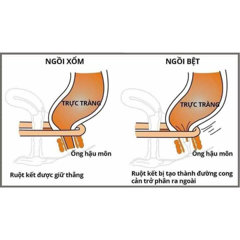 Ghế kê chân toilet chống táo bón - giải pháp tối ưu cho đường ruột