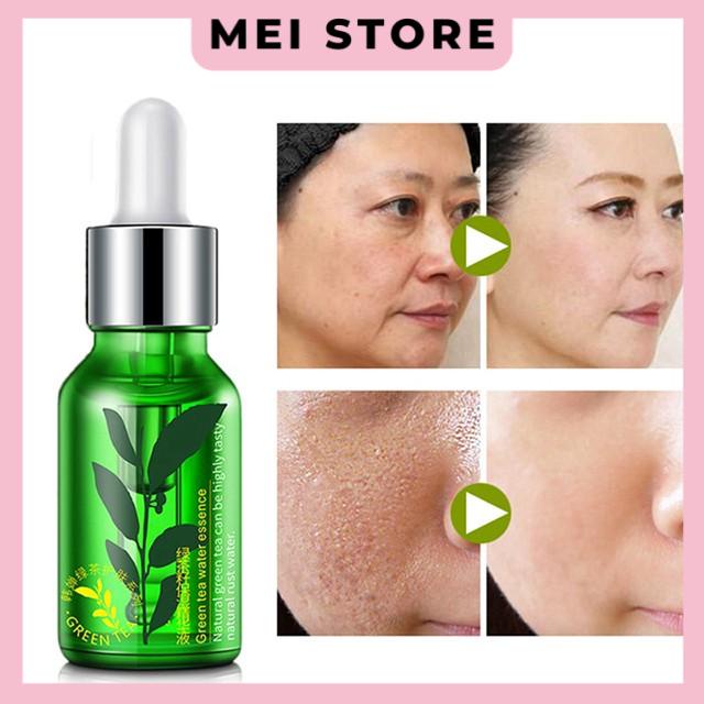 Serum dưỡng da lành mụn trà xanh Rorec 15ml