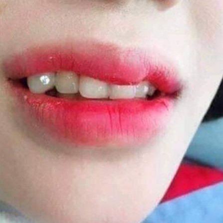 Đá đính răng sáng lung linh combo 10 viên kèm keo và bút dán