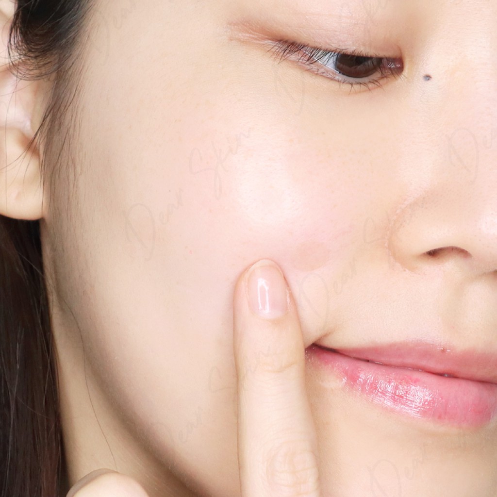 [Chính Hãng] Miếng Dán Mụn COSRX Acne Pimple Master Patch 24 miếng / gói - COSRX đỏ 24 miếng | BigBuy360 - bigbuy360.vn