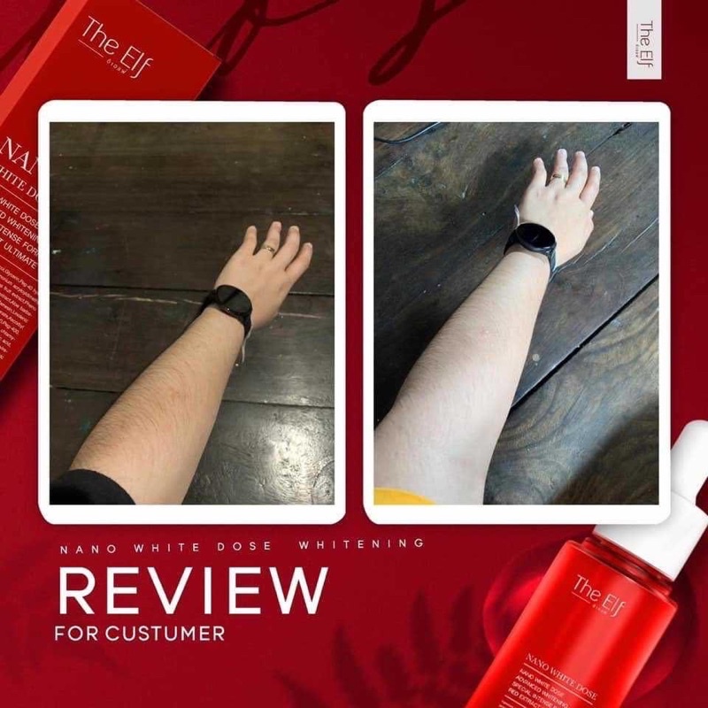 Serum truyền trắng mờ thâm sẹo The Elf Nano white dose Thái Land