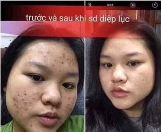 Đẹp da, dáng đẹp, eo thon cho mọi người