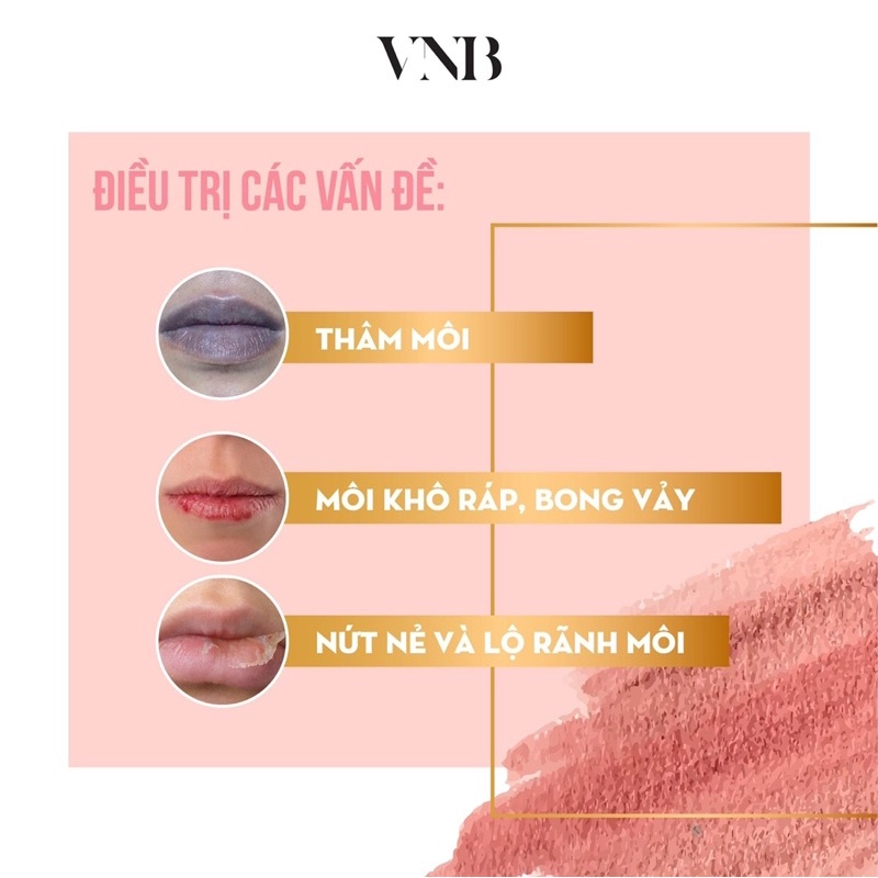 Ủ Môi Dưỡng Môi VNB 10gr