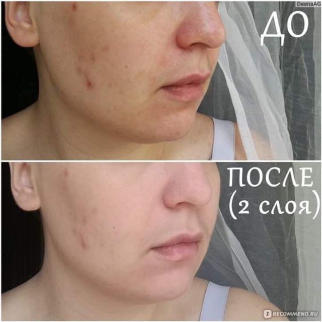 Kem nền dưỡng da Pureline 10in1 | BigBuy360 - bigbuy360.vn