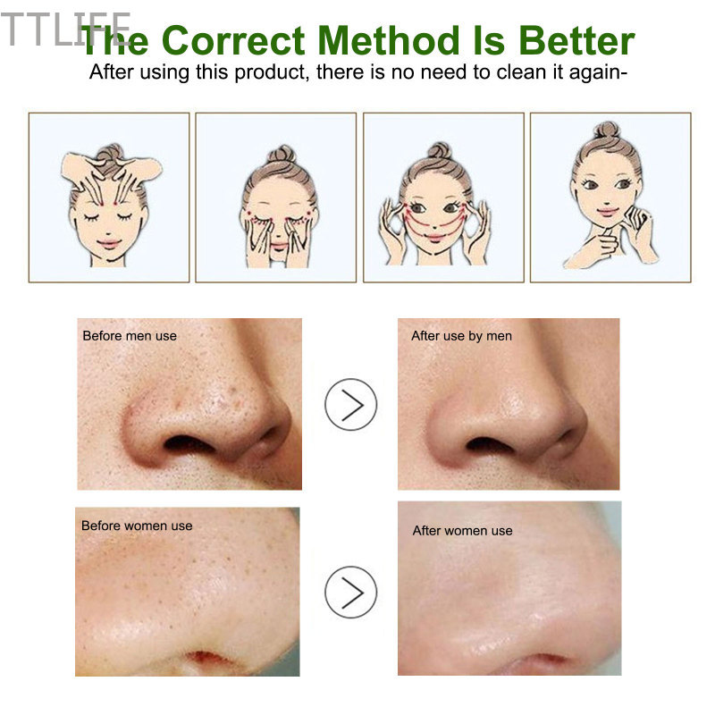 (Hàng Mới Về) Tinh Chất Hyaluronic Acid Dưỡng Ẩm Se Khít Lỗ Chân Lông Chống Lão Hóa Làm Trắng Da 10ml | BigBuy360 - bigbuy360.vn