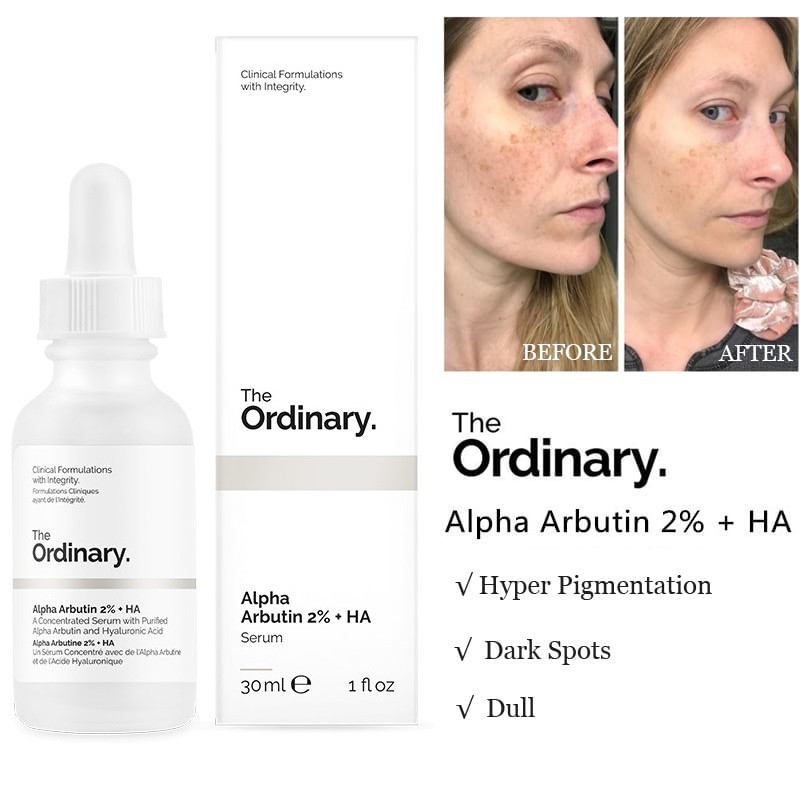 Tinh Chất Dưỡng Trắng Da, Giảm Thâm The Ordinary Alpha Arbutin 2% + HA Serum 30ml