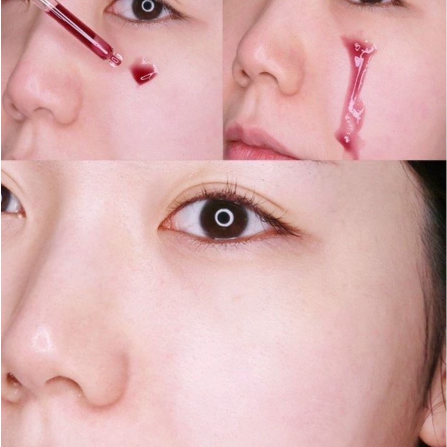 Red Peel Tingle Serum 35ml/10ml Tinh Chất Tái Tạo Da Chính Hãng So Natural