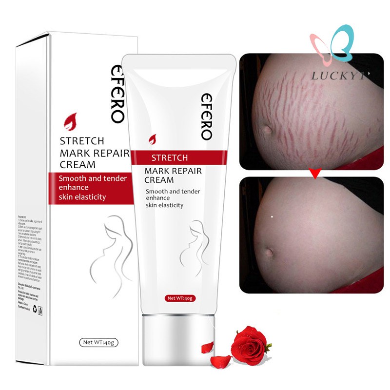 [Hàng mới về] Kem chữa sẹo và rạn da hiệu quả cho phụ nữ sau sinh  | BigBuy360 - bigbuy360.vn