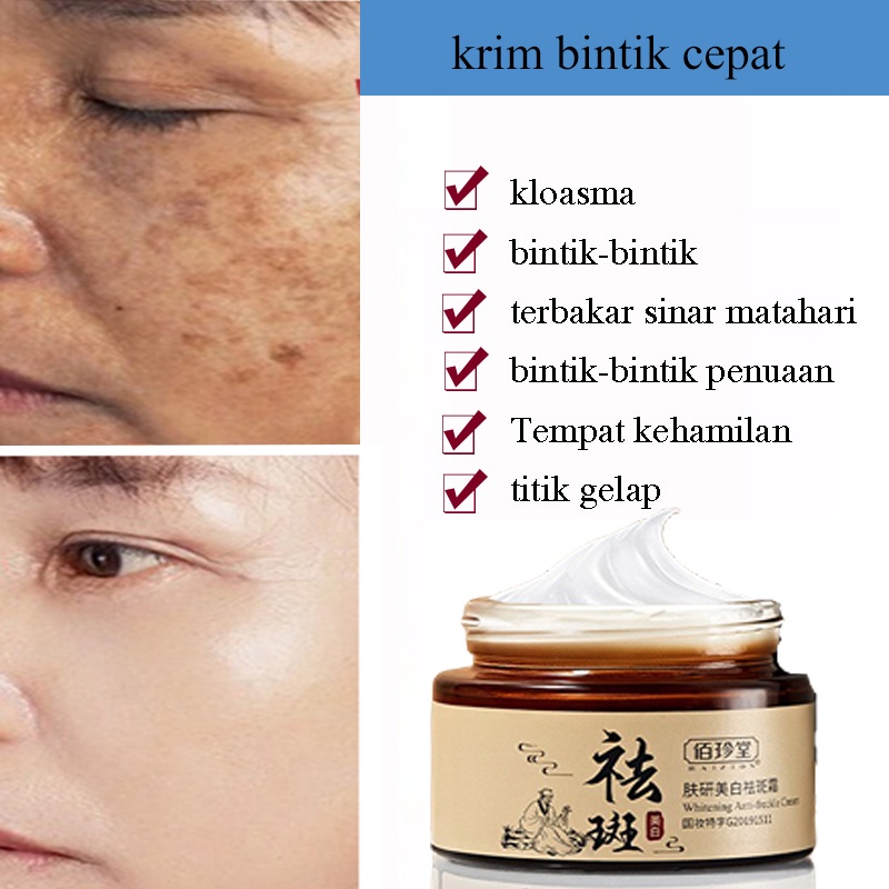 dưỡng trắng da mặt 30g kem duong trang da mat kem trị tan nhang serum mờ tàn nhang chấm tàn nhang