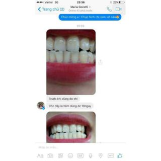 Kem đánh răng làm trắng than hoạt tính