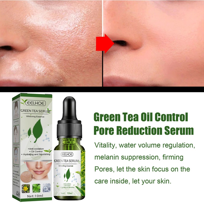 Serum Trà Xanh Kiểm Soát Dầu Thu Nhỏ Lỗ Chân Lông Làm Trắng Da Loại Bỏ Đốm Đen Cải Thiện
