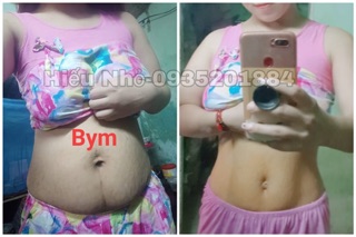 Combo tan mỡ bụng