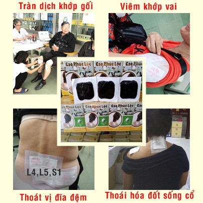 Cao đắp bệnh đau xương khớp ( thoái hóa, thoát vị, tràn dịch, viêm khớp...) Phúc Lộc