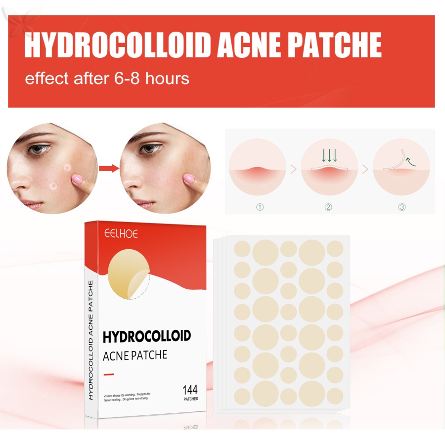 Miếng Dán Hỗ trợ giảm mụn Hydro Hydro Hydro Hydro hydroclloid Vô Hình Thoáng Khí Chống Thấm Nước