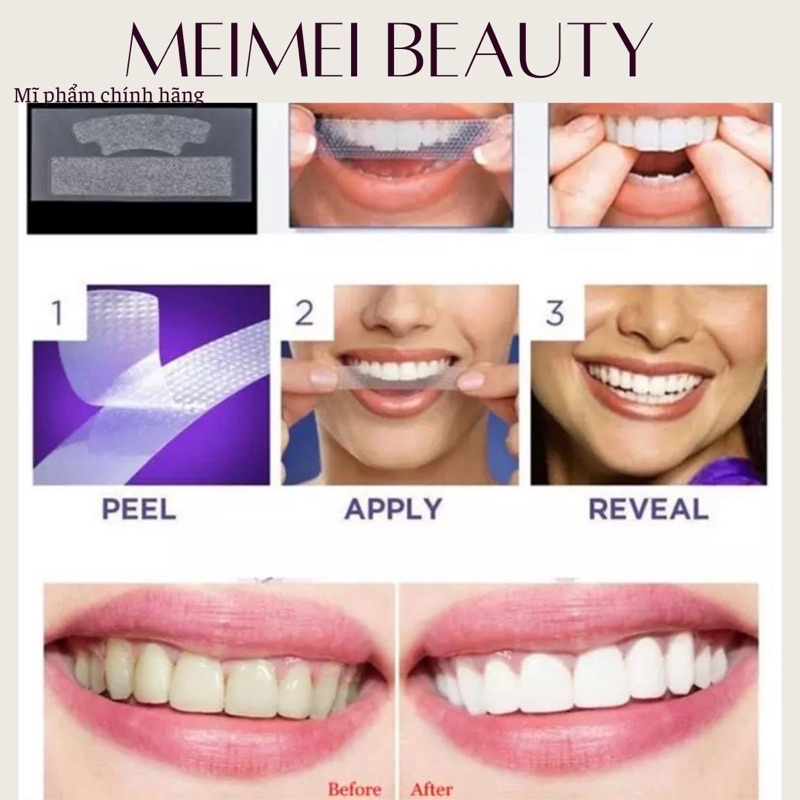 Miếng dán trắng răng tiện lợi 3D 5D White Teeth Whitening Strips full hộp 7 tờ MeiMei Beauty