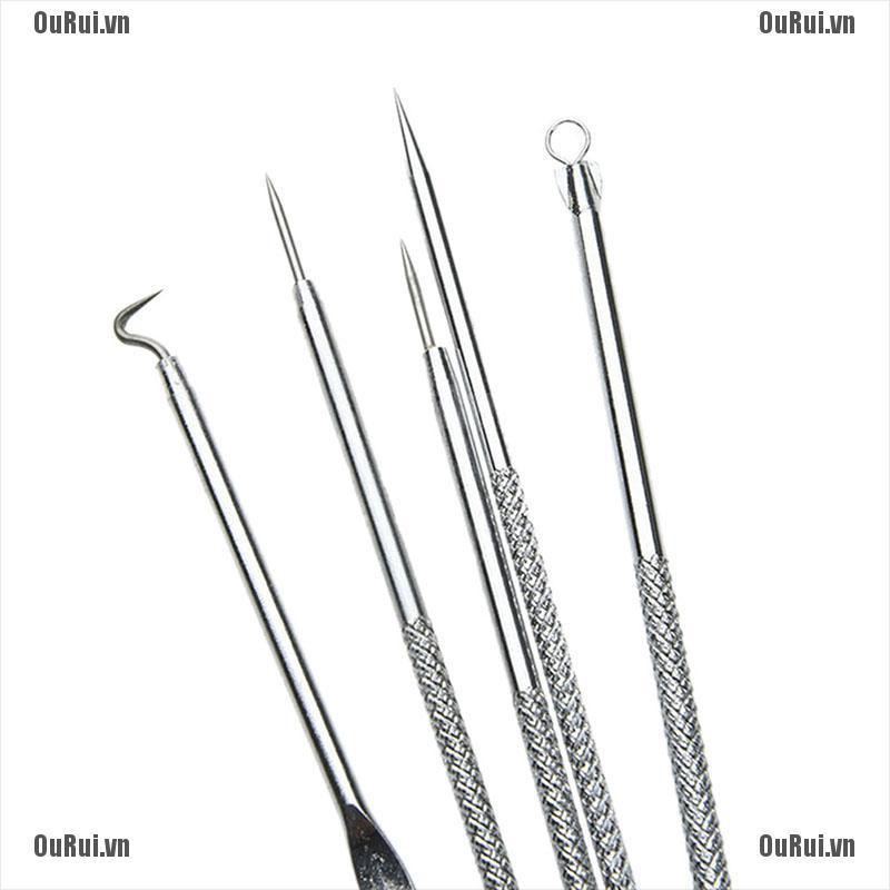 (Hàng Mới Về) Set 5 Nhíp Nặn Mụn An Toàn Chất Lượng Cao