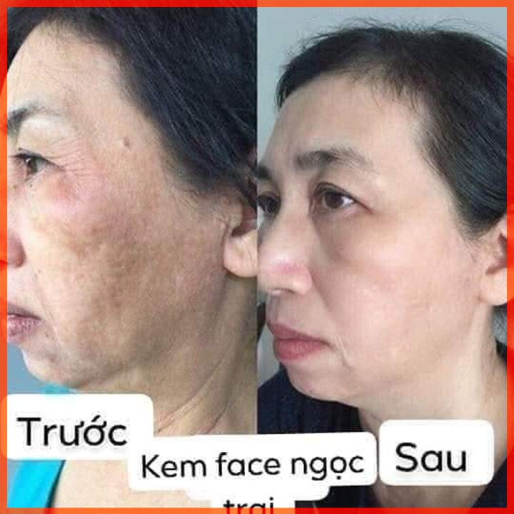 Kem Face Ngọc Trai CRD Cherry Đào Dưỡng Trắng Da Mặt Ban Đêm Mờ Thâm Nám Tàn Nhang