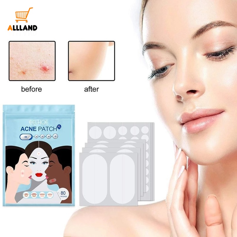 Set 80 Miếng Dán Hỗ Trợ Giảm Mụn Hydrocolloid Vô Hình Và Chăm Sóc Da