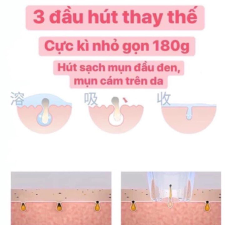 Máy Hút Mụn 3 Đầu Hút 2 Chế Độ Sóng Âm