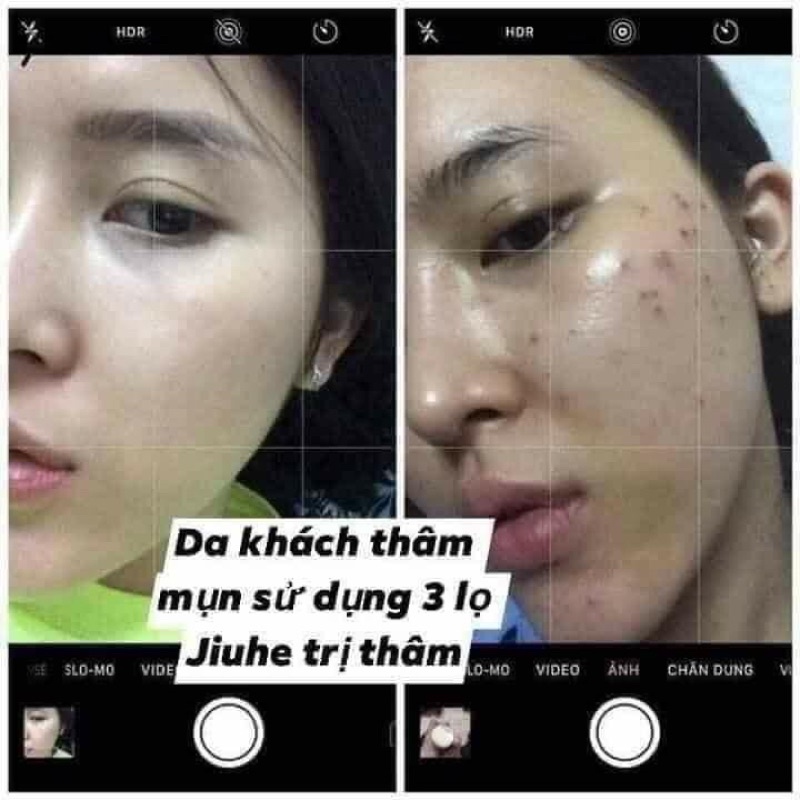 Serum giảm thâm Jiuhe Bye-Bye Melano 5ml - Mỹ phẩm Thanh Tô Chính Hãng