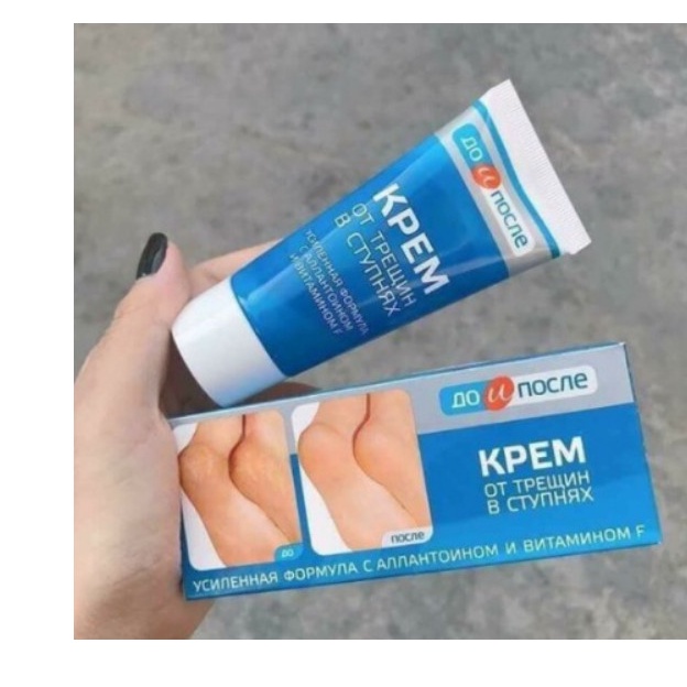 Kem nẻ gót chân Kpem Foot Cream Nga giảm nẻ chân nứt chân khô da chân dưỡng gót chân - [𝐓𝐚̣̆𝐧𝐠 𝐦𝐚́𝐲 𝐦𝐚𝐬𝐬𝐚𝐠𝐞 𝐦𝐚̣̆𝐭]