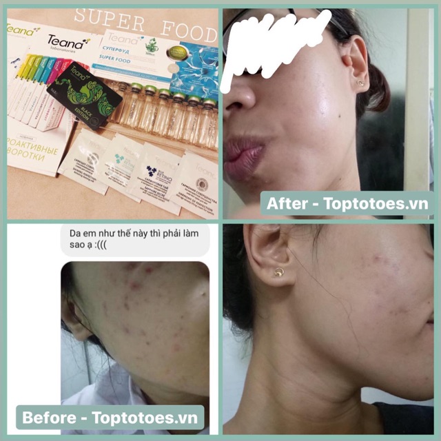 Serum Teana Stress Control Super Food giúp căng bóng, sáng hồng, tái tạo da