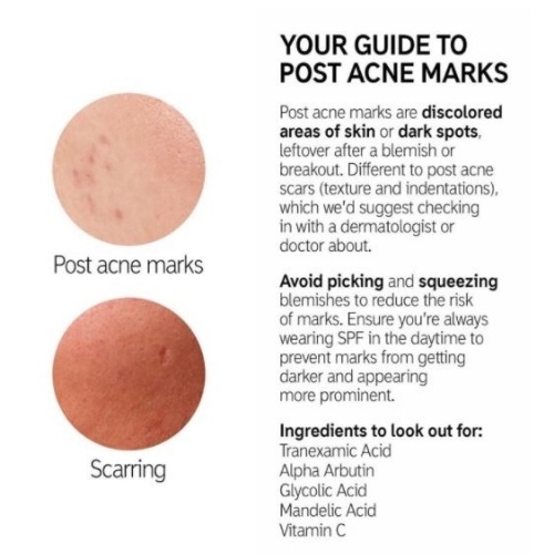 Tinh Chất Dưỡng Da The INKEY List Tranexamic Acid Hyperpigmentation Treatment - licyhouse