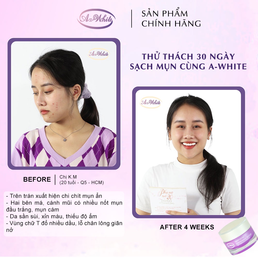 [COMBO SIÊU TIẾT KIỆM] - 3 KEM GIẢM MỤN &amp; DƯỠNG TRẮNG DA A-WHITE 25G
