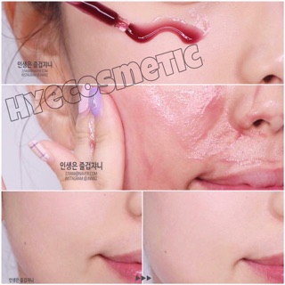 Tẩy tế bào chết red peel tingle serum