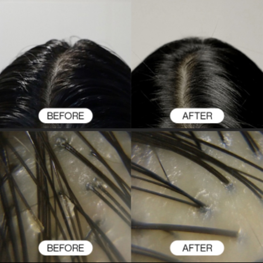 Liệ.u pháp tẩy tế bào chết da đầu với muối biển Growus Sea Salt Therapy Scalp Scaler 250g